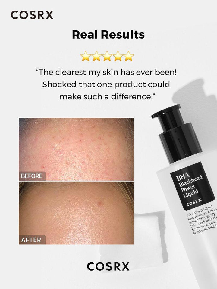COSRX BHA Blackhead Power Liquid with Betaine Salicylate 4% for Exfoliating